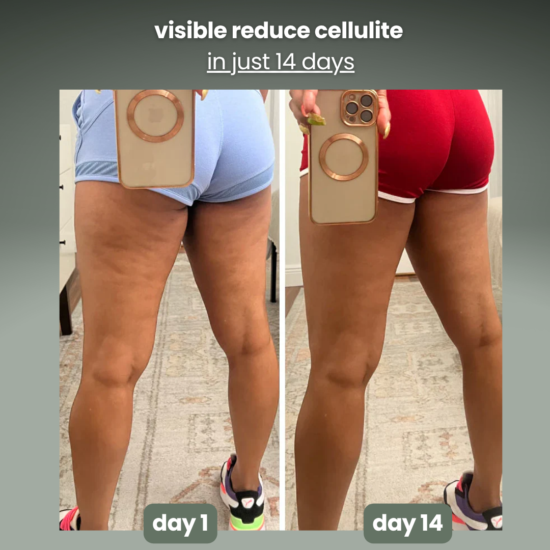 nymoly manual lymphatic massager