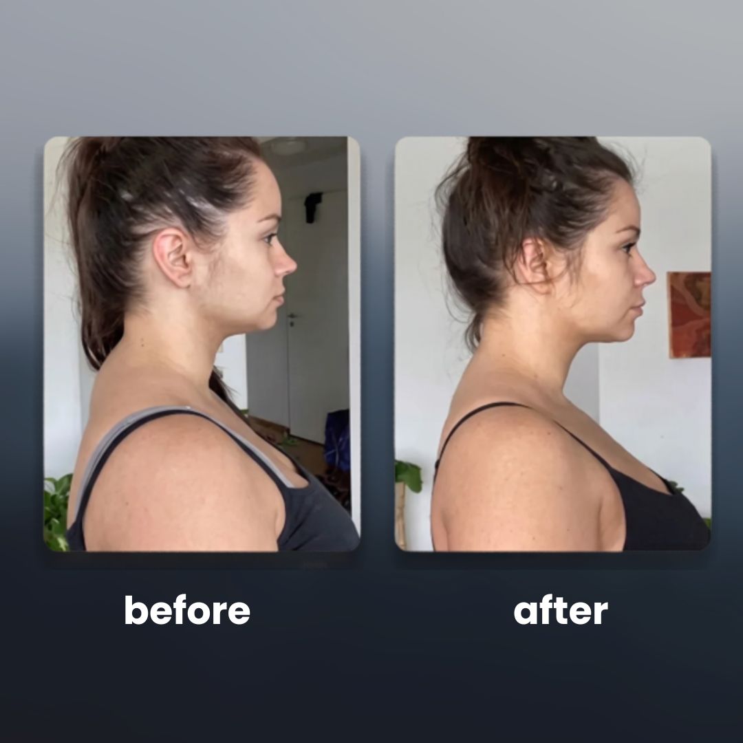 Scapora EMS Posture Trainer
