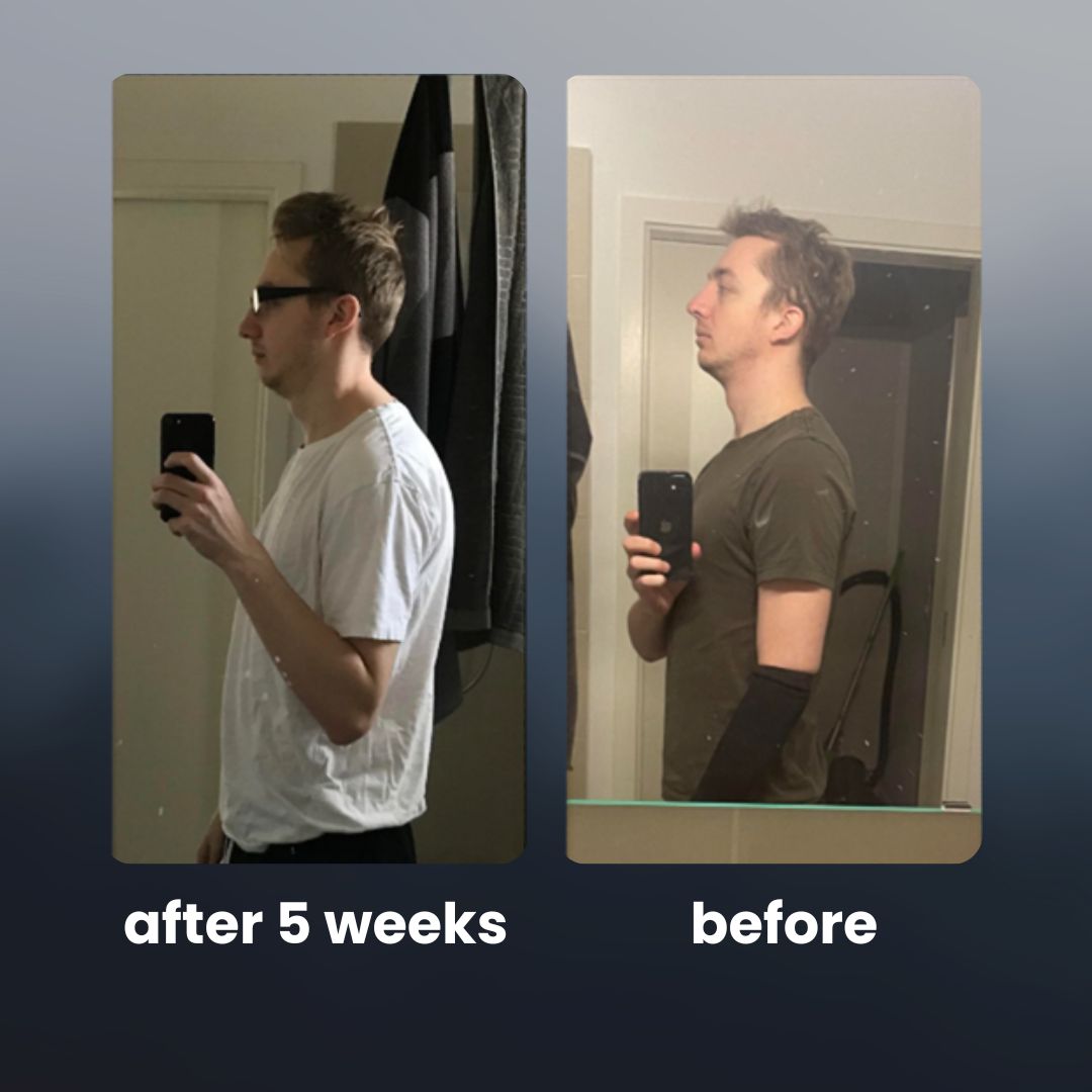 Scapora EMS Posture Trainer