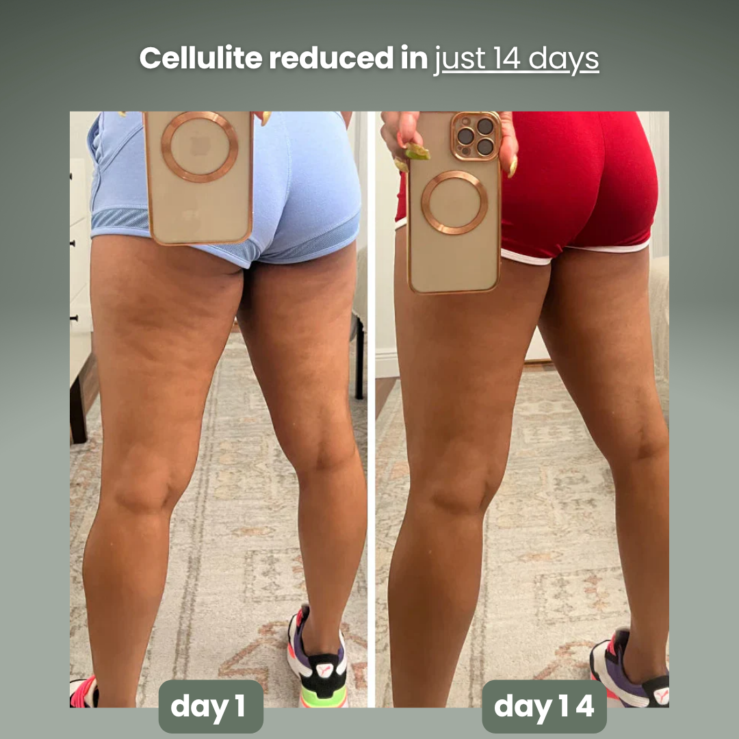 nymoly anti-cellulite massage oil