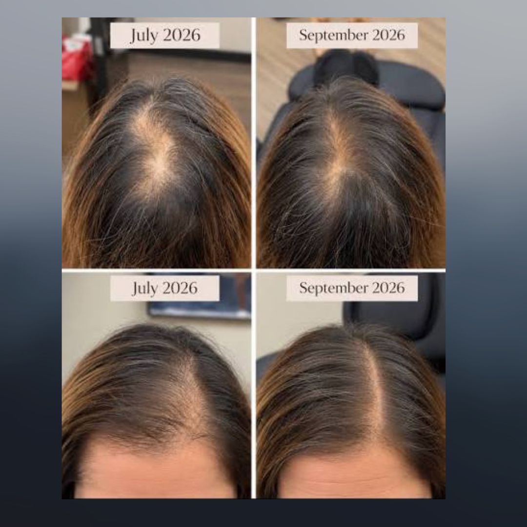 revive - 3-in-1 scalp massager for thinning hair