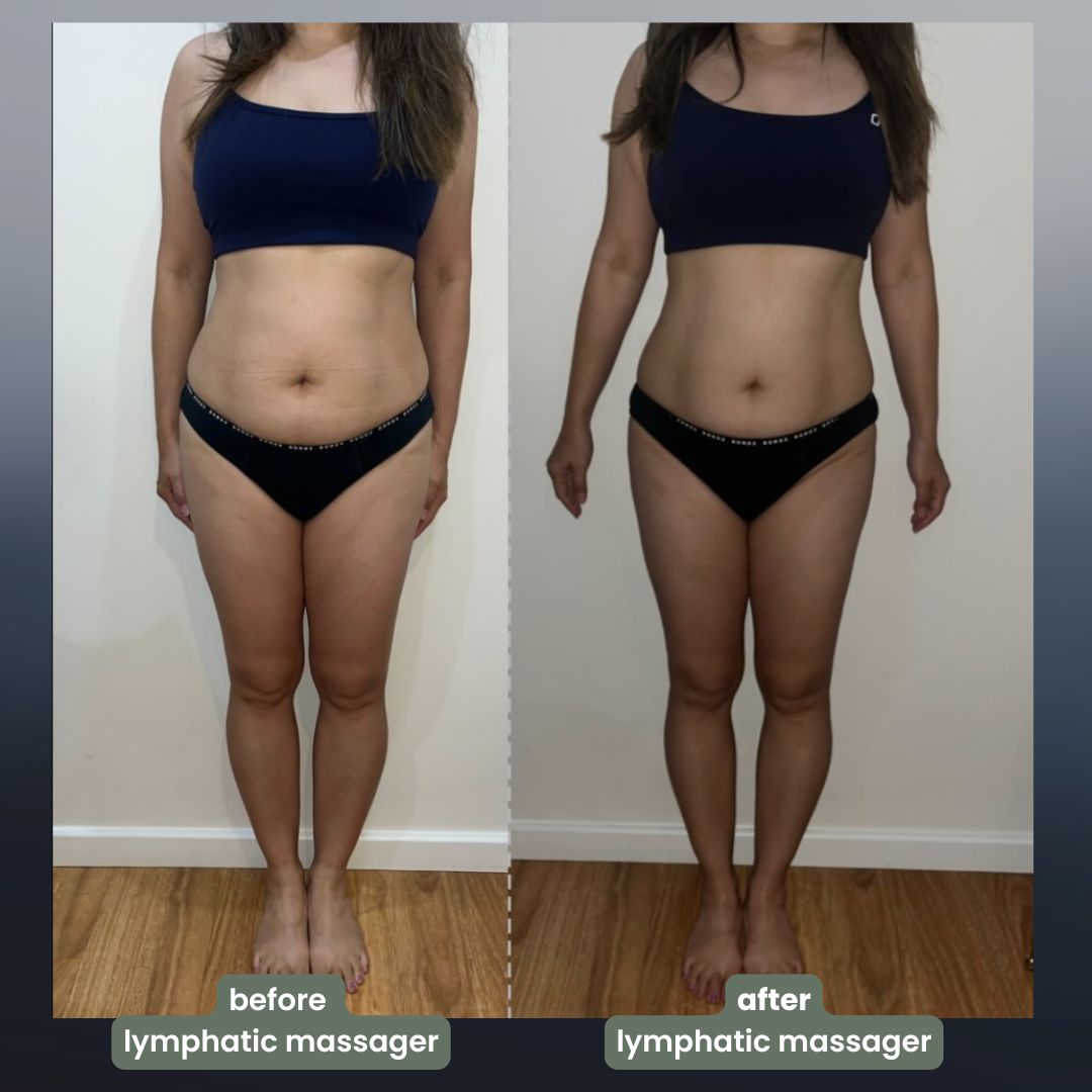 nymoly 4-in-1 lymphatic drainage massager