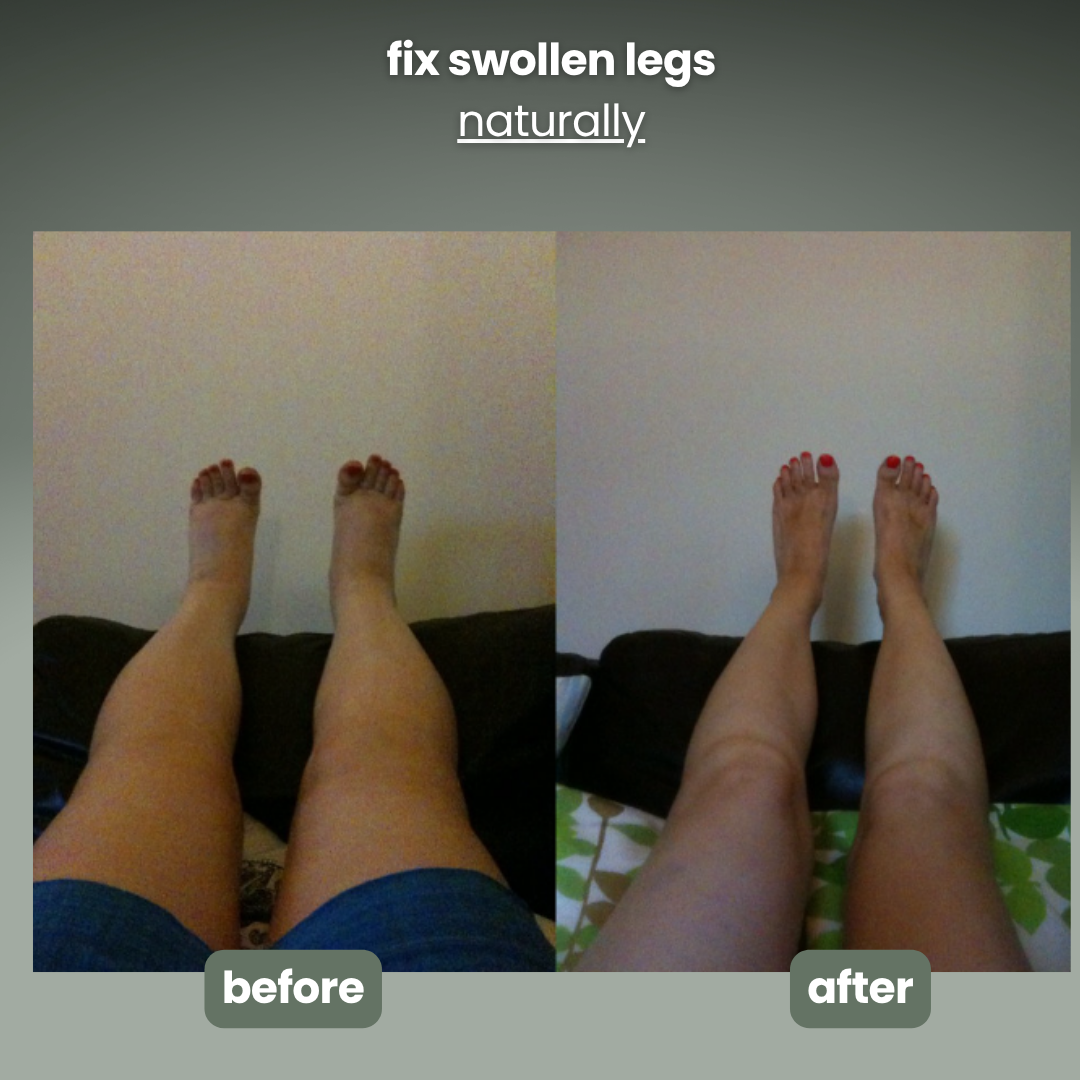 nymoly manual lymphatic massager